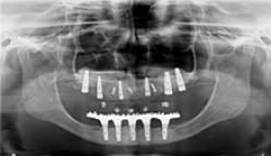 radiografia digital